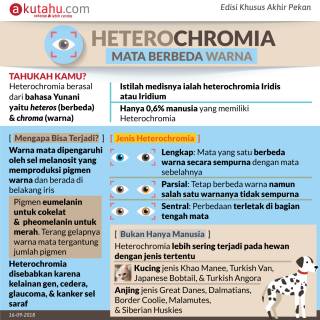 Heterochromia, Mata Berbeda Warna
