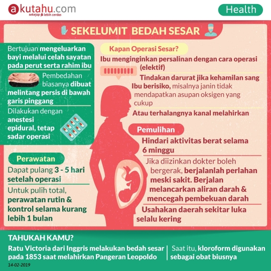 Sekelumit Bedah Sesar