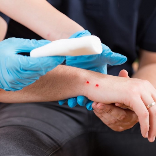 Mitos Pertolongan Pertama Yang Sering Kita Dengar 